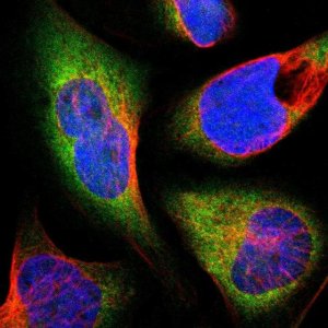 Anti-THRA antibody produced in rabbit 