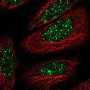 Anti-THRB antibody produced in rabbit 
