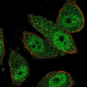 Anti-THSD7B antibody produced in rabbit 
