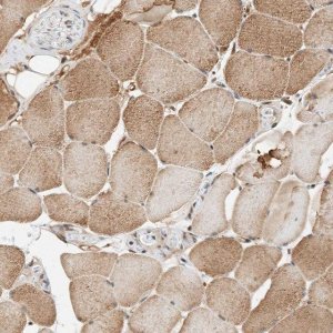 Anti-THTPA antibody produced in rabbit 