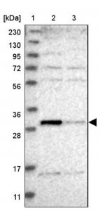 Anti-THTPA antibody produced in rabbit 