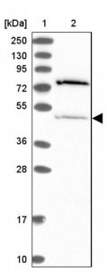 Anti-THUMPD2 antibody produced in rabbit 
