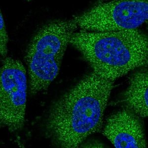 Anti-THUMPD3 antibody produced in rabbit 
