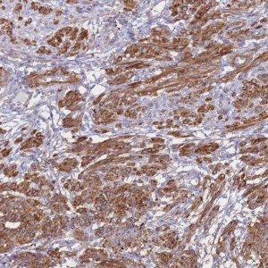 Anti-TIAF1 antibody produced in rabbit 