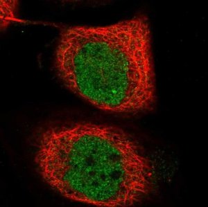 Anti-TICRR antibody produced in rabbit 