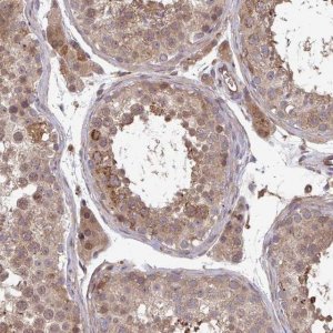 Anti-TIGAR antibody produced in rabbit 