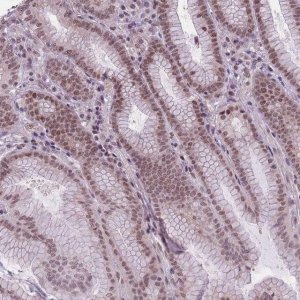 Anti-TIGD1 antibody produced in rabbit 