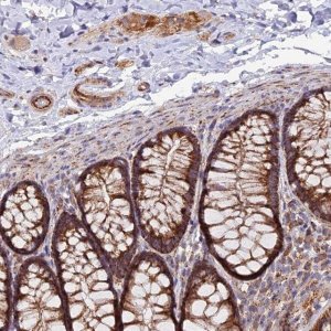 Anti-TIGD6 antibody produced in rabbit 