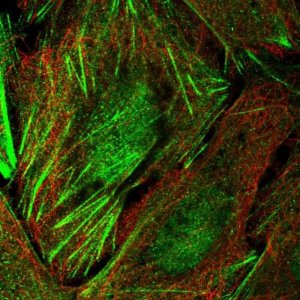 Anti-TIGD6 antibody produced in rabbit 