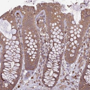 Anti-TIGD7 antibody produced in rabbit 