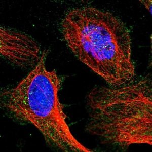 Anti-TIGD7 antibody produced in rabbit 