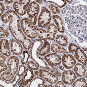 Anti-TIMM10 antibody produced in rabbit 
