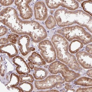 Anti-TIMM10B antibody produced in rabbit 