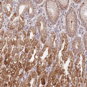 Anti-TIMM13 antibody produced in rabbit 