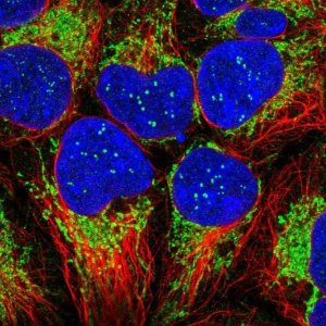 Anti-TIMM13 antibody produced in rabbit 