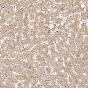 Anti-TIMM17A antibody produced in rabbit 