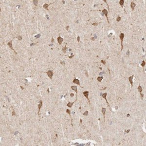 Anti-TIMM17A antibody produced in rabbit 