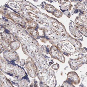 Anti-TIMM17B antibody produced in rabbit 