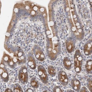 Anti-TIMM17B antibody produced in rabbit 