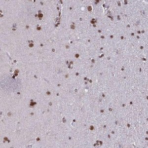 Anti-TIMM21 antibody produced in rabbit 