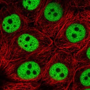 Anti-TIMM21 antibody produced in rabbit 