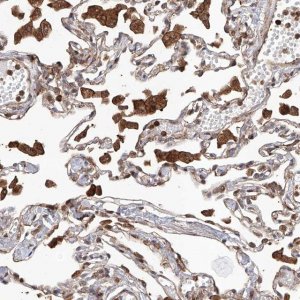 Anti-TIMM23 antibody produced in rabbit 