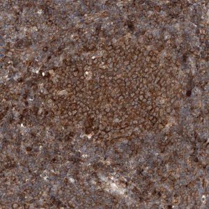 Anti-TIMM23 antibody produced in rabbit 
