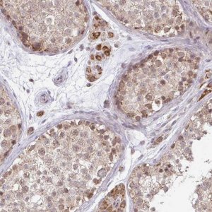 Anti-TIMM50 antibody produced in rabbit 