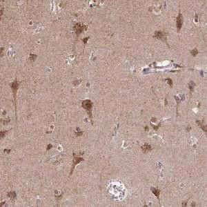 Anti-TIMM50 antibody produced in rabbit 