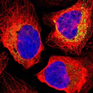 Anti-TIMM8A antibody produced in rabbit 