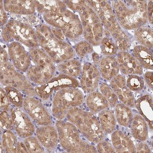 Anti-TIMM8B antibody produced in rabbit 