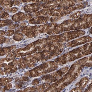 Anti-TIMM9 antibody produced in rabbit 