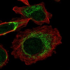 Anti-TIMMDC1 antibody produced in rabbit 