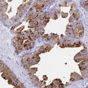 Anti-TIMP1 antibody produced in rabbit 