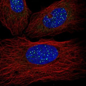Anti-TINF2 antibody produced in rabbit 
