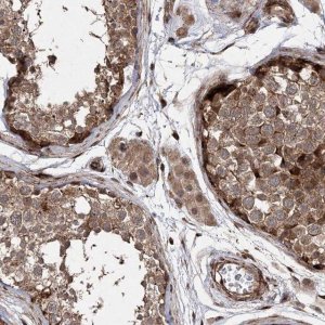 Anti-TIPARP antibody produced in rabbit 
