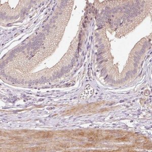 Anti-TIRAP antibody produced in rabbit 