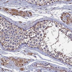 Anti-TK2 antibody produced in rabbit 