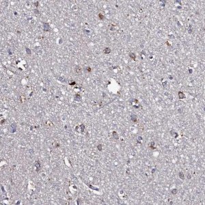 Anti-TK2 antibody produced in rabbit 