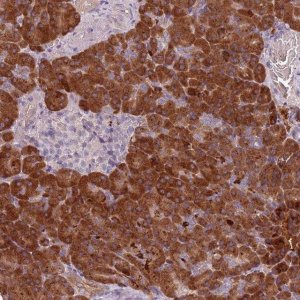 Anti-TLCD2 antibody produced in rabbit 