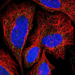 Anti-TLCD2 antibody produced in rabbit 
