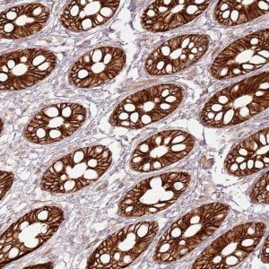 Anti-TLDC2 antibody produced in rabbit 