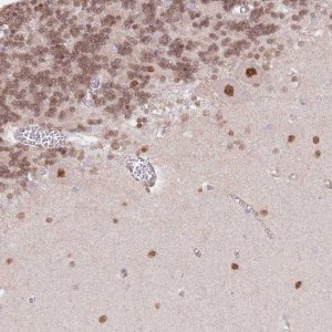 Anti-TLE2 antibody produced in rabbit 