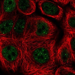 Anti-TLE2 antibody produced in rabbit 