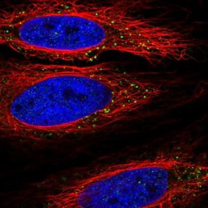 Anti-TLL1 antibody produced in rabbit HPA060767-100UL