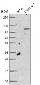 Anti-TLL1 antibody produced in rabbit HPA060767-100UL