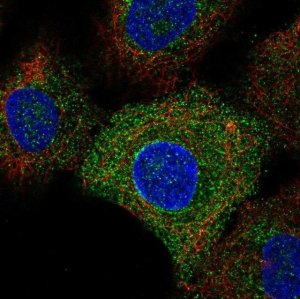 Anti-TLR6 antibody produced in rabbit 