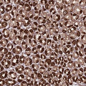 Anti-TM2D2 antibody produced in rabbit 