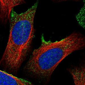 Anti-TM2D2 antibody produced in rabbit 