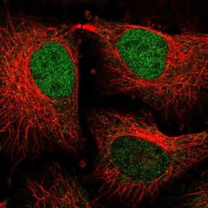 Anti-TM2D3 antibody produced in rabbit 